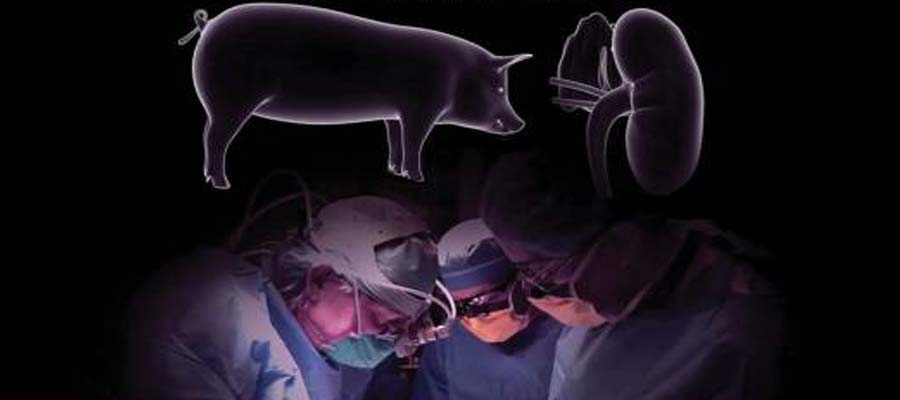 Transplantasi Ginjal Babi